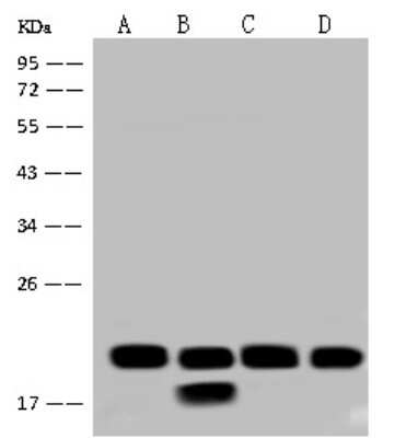 Western Blot: NDUFB7 Antibody [NBP2-97854]