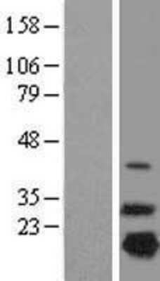 Western Blot: NDUFB7 Overexpression Lysate [NBL1-13555]