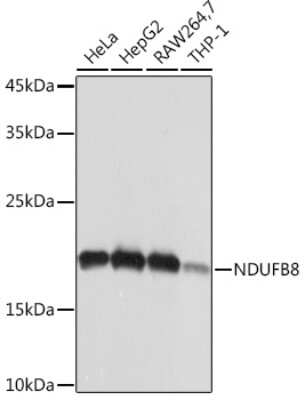 Western Blot: NDUFB8 Antibody (6T8G1) [NBP3-15882]
