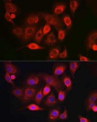 Immunocytochemistry/ Immunofluorescence: NDUFB8 Antibody - Azide and BSA Free [NBP3-16016]