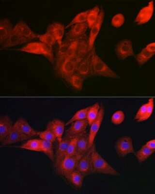 Immunocytochemistry/ Immunofluorescence: NDUFB8 Antibody - Azide and BSA Free [NBP3-16016]