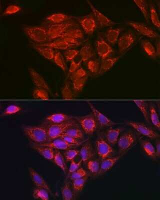 Immunocytochemistry/ Immunofluorescence: NDUFB8 Antibody - Azide and BSA Free [NBP3-16016]