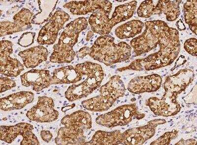 Immunohistochemistry-Paraffin: NDUFB8 Antibody [NBP3-05965]