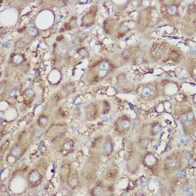 Immunohistochemistry-Paraffin: NDUFB8 Antibody - Azide and BSA Free [NBP3-16016]