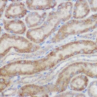 Immunohistochemistry-Paraffin: NDUFB8 Antibody - Azide and BSA Free [NBP3-16016]