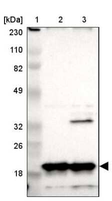 Western Blot: NDUFB8 Antibody [NBP1-88859]