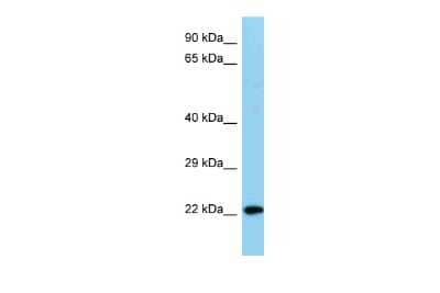 Western Blot: NDUFB8 Antibody [NBP2-85372]