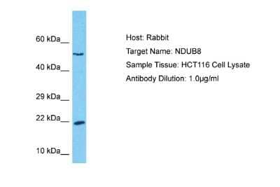 Western Blot: NDUFB8 Antibody [NBP2-85373]