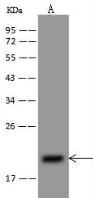 Western Blot: NDUFB8 Antibody [NBP3-05965]