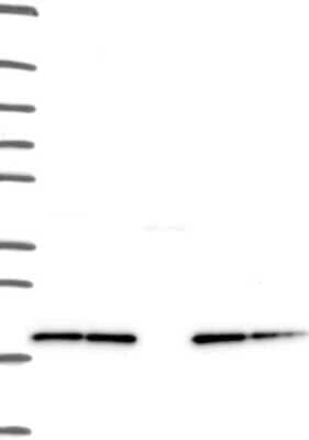 Western Blot: NDUFB8 Antibody [NBP3-17898]