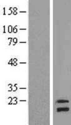 Western Blot: NDUFB8 Overexpression Lysate [NBL1-13556]