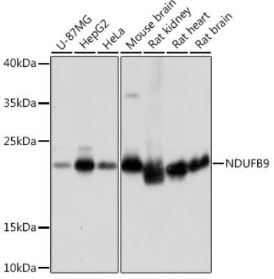 Western Blot: NDUFB9 AntibodyAzide and BSA Free [NBP2-93573]