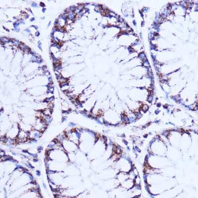Immunohistochemistry-Paraffin: NDUFB9 Antibody - Azide and BSA Free [NBP2-93573]