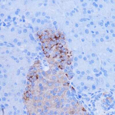 Immunohistochemistry-Paraffin: NDUFB9 Antibody - Azide and BSA Free [NBP2-93573]