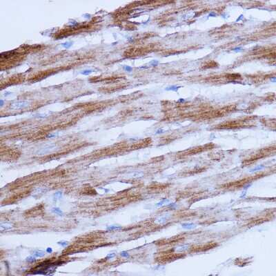 Immunohistochemistry-Paraffin: NDUFB9 Antibody - Azide and BSA Free [NBP2-93573]
