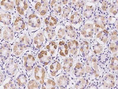 Immunohistochemistry-Paraffin: NDUFB9 Antibody [NBP2-97197]