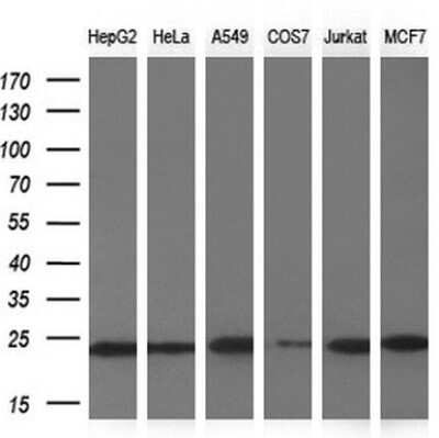 Western Blot: NDUFB9 Antibody (OTI13H11)Azide and BSA Free [NBP2-72919]