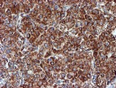 Immunohistochemistry: NDUFB9 Antibody (OTI13H11) [NBP2-46126]
