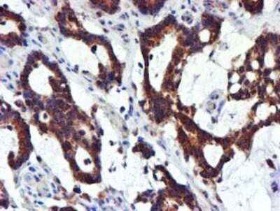 Immunohistochemistry: NDUFB9 Antibody (OTI13H11) [NBP2-46126]