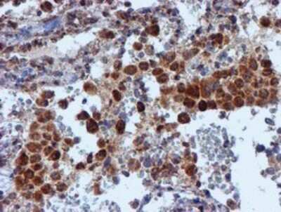 Immunohistochemistry: NDUFB9 Antibody (OTI13H11) [NBP2-46126]