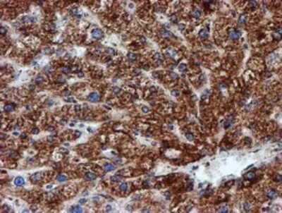 Immunohistochemistry: NDUFB9 Antibody (OTI13H11) [NBP2-46126]