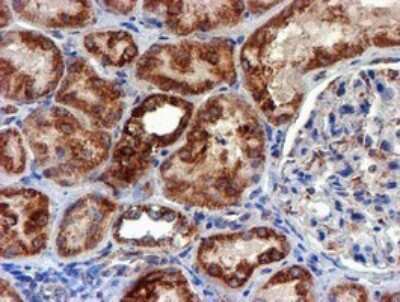 Immunohistochemistry: NDUFB9 Antibody (OTI13H11) [NBP2-46126]