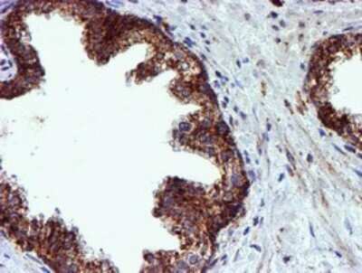 Immunohistochemistry: NDUFB9 Antibody (OTI13H11) [NBP2-46126]