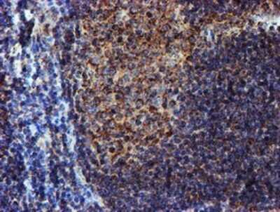 Immunohistochemistry: NDUFB9 Antibody (OTI13H11) [NBP2-46126]