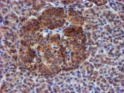 Immunohistochemistry: NDUFB9 Antibody (OTI13H11) [NBP2-46126]