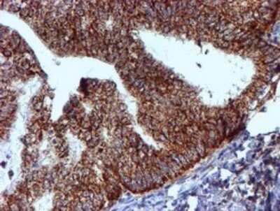 Immunohistochemistry: NDUFB9 Antibody (OTI13H11) [NBP2-46126]