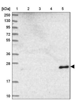 Western Blot: NDUFB9 Antibody [NBP1-88940]