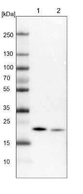 Western Blot: NDUFB9 Antibody [NBP1-88940]