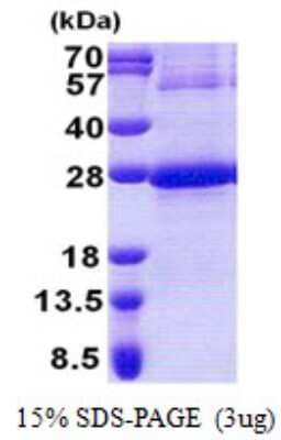 SDS-PAGE: Recombinant Human NDUFB9 His Protein [NBP2-23262]