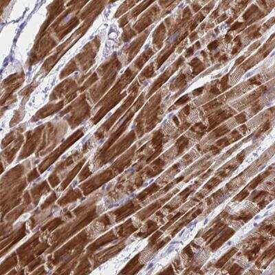 Immunohistochemistry-Paraffin: NDUFC2 Antibody [NBP2-46831]