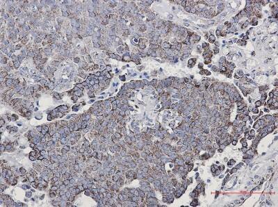 Immunohistochemistry-Paraffin: NDUFC2 Antibody (S05-2C2) [NBP3-19710]