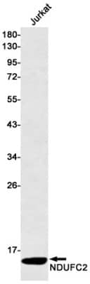 Western Blot: NDUFC2 Antibody (S05-2C2) [NBP3-19710]