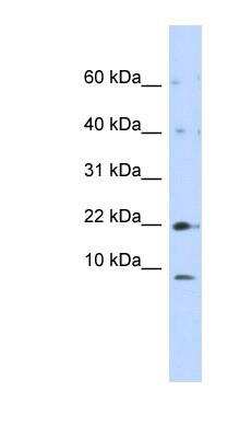 Western Blot: NDUFC2 Antibody [NBP1-59610]