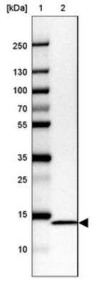 Western Blot: NDUFC2 Antibody [NBP1-88934]