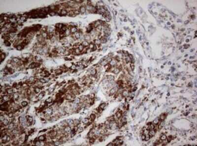 Immunohistochemistry: NDUFS2 Antibody (OTI1D5) [NBP2-46127]