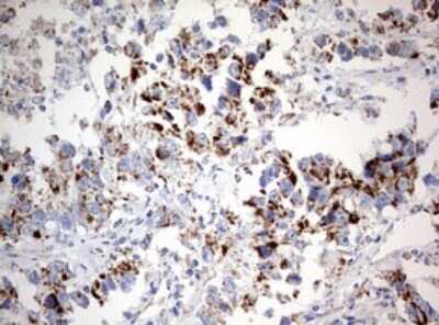 Immunohistochemistry: NDUFS2 Antibody (OTI1D5) [NBP2-46127]