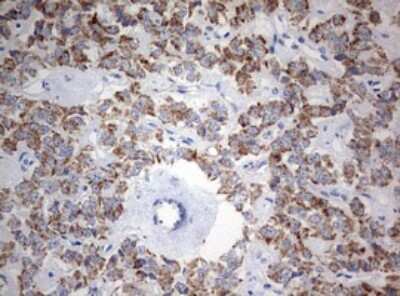 Immunohistochemistry: NDUFS2 Antibody (OTI1D5) [NBP2-46127]
