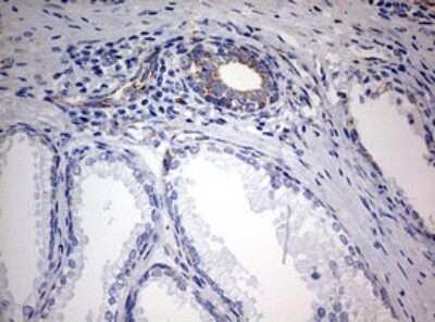 Immunohistochemistry: NDUFS2 Antibody (OTI1D5) [NBP2-46127]