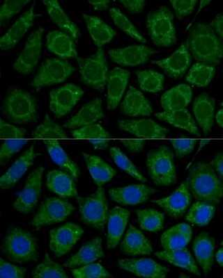 Immunocytochemistry/ Immunofluorescence: NDUFS2 Antibody - Azide and BSA Free [NBP3-03566]