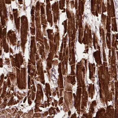 Immunohistochemistry: NDUFS2 Antibody [NBP2-49351]