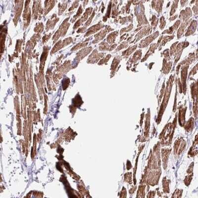 Immunohistochemistry-Paraffin: NDUFS2 Antibody [NBP2-30413]