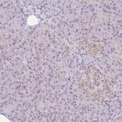 Immunohistochemistry-Paraffin: NDUFS2 Antibody [NBP2-30413]