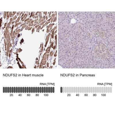 Immunohistochemistry-Paraffin: NDUFS2 Antibody [NBP2-30413]