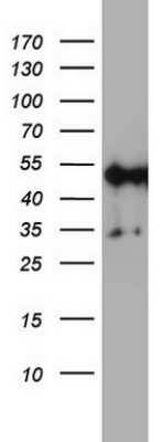 Western Blot: NDUFS2 Antibody (OTI1D5)Azide and BSA Free [NBP2-72921]