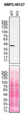 Knockout Validated: NDUFS2 Antibody (OTI1D5) [NBP2-46127]