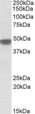 Western Blot: NDUFS2 Antibody [NBP1-52061]